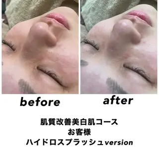 ネイル・エステサロン UILANIのエステ・リラクイメージ