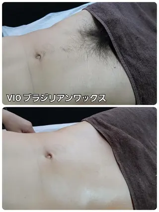 メンズ 山村幸久 メンズ脱毛 ディアーズのエステ・リラクイメージ