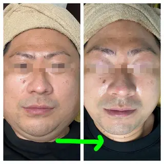 salon de epilaのエステ・リラクイメージ