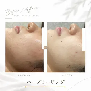 《 肌質×美肌 》 addissimoのエステ・リラクイメージ