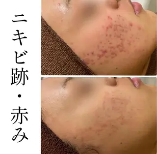 ハーブピーリング専門 BIOPLUS+川崎のエステ・リラクイメージ