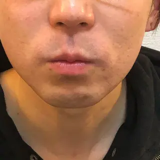 メンズ トータルビューティー マウロアのエステ・リラクイメージ