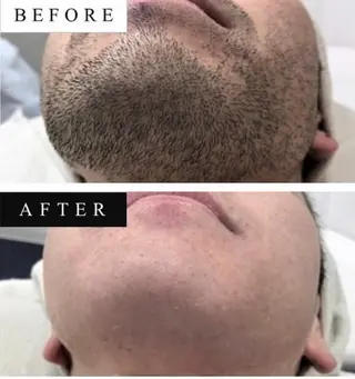 メンズ salon ONEのエステ・リラクイメージ
