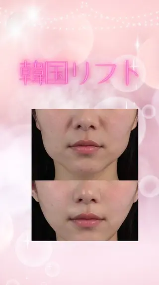 マツエク・マツパ 愛維美水光専門店 川崎彩鳳のエステ・リラクイメージ