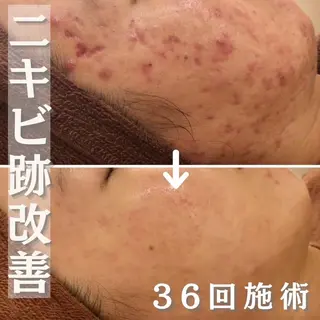 ミディアム カラー パーマ ヘアアレンジ メンズ キッズ ネイル マツエク・マツパ アイブロウ ニキビ・肌質改善専門 ♡人生が変わるサロンのエステ・リラクイメージ