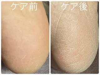 美肌シミケアサロン 4tune.RUMIのその他イメージ