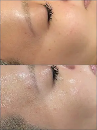 LiZA エステティックサロンのエステ・リラクイメージ