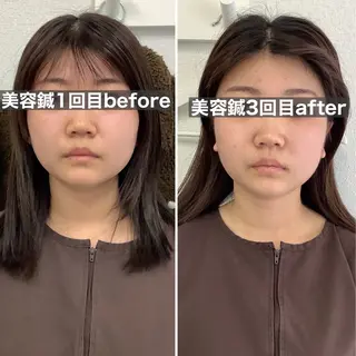 ハリサロンドオフ 美容鍼灸×小顔整体のエステ・リラクイメージ