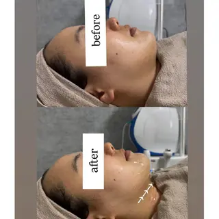 【韓国肌管理・脱毛】 クレセントのその他イメージ