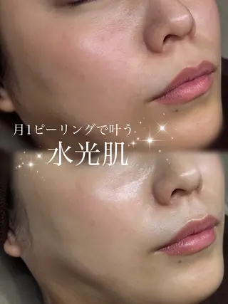 肌質改善×癒しサロン Ryanのエステ・リラクイメージ