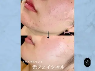 岡崎🦋SOYOU 韓国肌管理のエステ・リラクイメージ