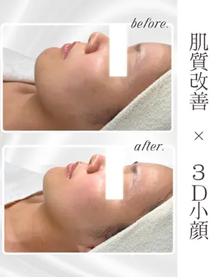 LiAm《韓国管理/ 小顔/脂肪ケア》のエステ・リラクイメージ