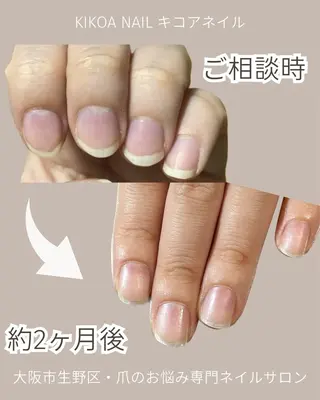 ネイル KIKOA NAIL キコアネイルのネイルデザイン