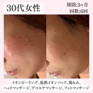 ニキビ・肌質改善専門 ♡人生が変わるサロンのエステ・リラクイメージ