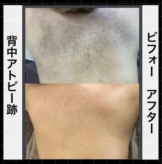 ハーブピーリング専門 MOKAのエステ・リラクイメージ