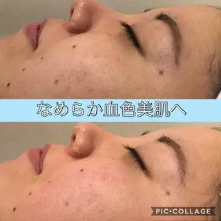 ロング カラー パーマ ヘアアレンジ キッズ ネイル マツエク・マツパ EnsorClair 代表 野口真央のエステ・リラクイメージ