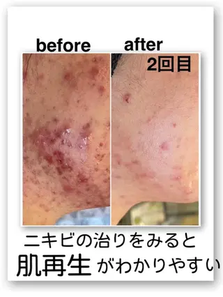 脱毛サロン mamanaのエステ・リラクイメージ