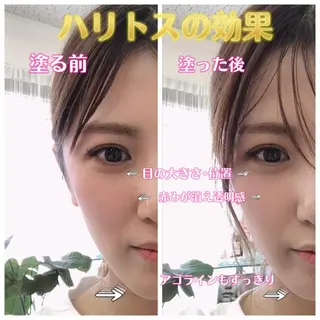 【小顔矯正】 salonaceのエステ・リラクイメージ