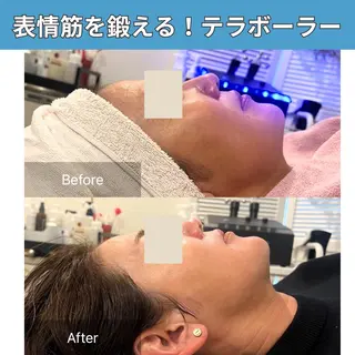 ielu〜毛穴ケア ハーブピーリングのエステ・リラクイメージ