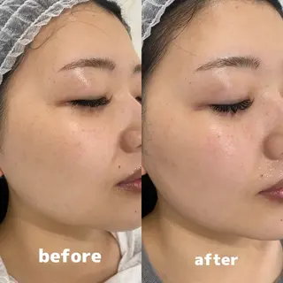 Whitening Beauty 行橋店のその他イメージ