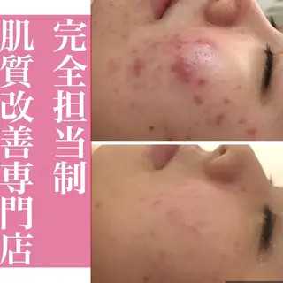 ミディアム カラー パーマ ヘアアレンジ メンズ キッズ ネイル マツエク・マツパ ニキビ・肌質改善専門 ♡人生が変わるサロンのエステ・リラクイメージ