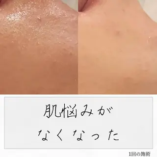 ニキビ経験者が施術 する専門サロン🌻のエステ・リラクイメージ