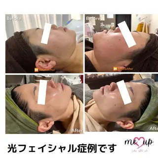 Meupニキビ専門店 背中/ハーブ/肌管理のその他イメージ