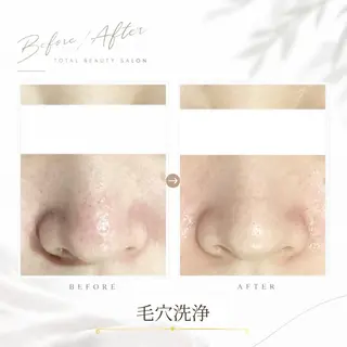 《 肌質×美肌 》 addissimoのエステ・リラクイメージ