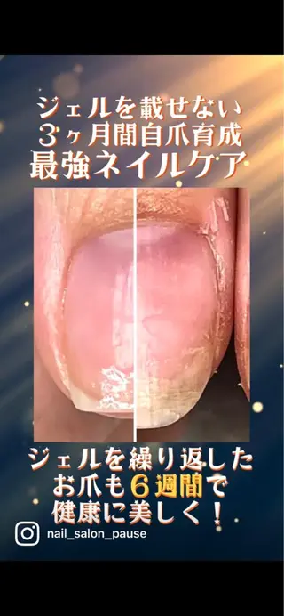 ネイル 自爪育成ネイルサロン Pause(ポーズ)のネイルデザイン