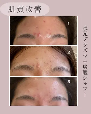 小顔＆肌質改善 NICORIのエステ・リラクイメージ