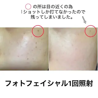 セミロング メンズ ネイル マツエク・マツパ セルフ脱毛 One Salonのエステ・リラクイメージ