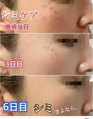 SPOT.com  シミケア専門店のエステ・リラクイメージ