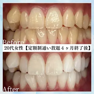メンズ キッズ セルフホワイトニング WHITE福岡天神店のエステ・リラクイメージ