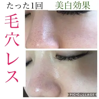 セミロング カラー パーマ ヘアアレンジ キッズ ネイル マツエク・マツパ EnsorClair 代表 野口真央のエステ・リラクイメージ