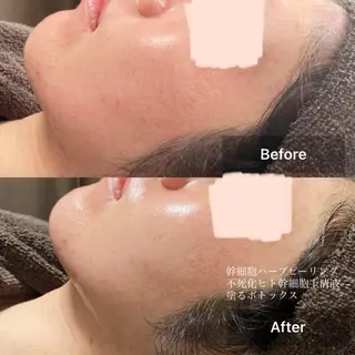 メンズ キッズ 美肌と癒しのサロン Lu,Mieのエステ・リラクイメージ