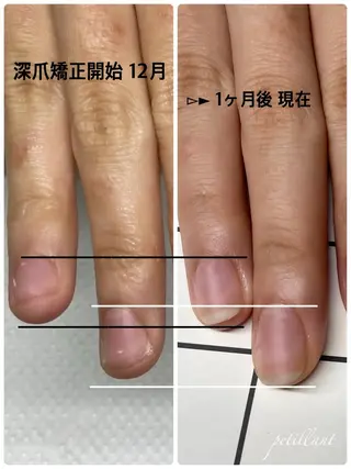 ネイル nail salon petillantのネイルデザイン