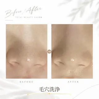 《 肌質×美肌 》 addissimoのエステ・リラクイメージ