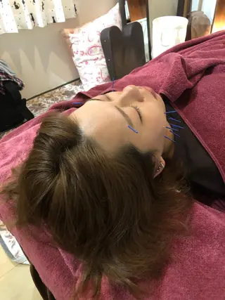 美容鍼灸女性専用 りんご鍼灸治療院のエステ・リラクイメージ