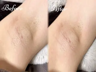 PIMIL佐々木 亜里沙のエステ・リラクイメージ