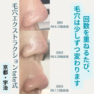 ネイル 粟津 美紀のエステ・リラクイメージ