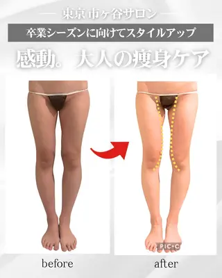 痩身専門エステサロン Eclatのエステ・リラクイメージ