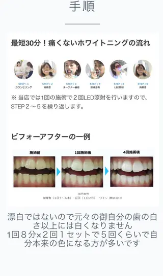 luceat Rのマツエク・マツパデザイン