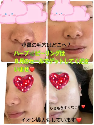 ❤️予約殺到❤️mi オールハンド痩身専門のエステ・リラクイメージ