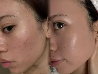 艶肌デトックス🫧 Samiraのエステ・リラクイメージ