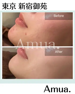 ネイル・ハーブ Amua.新宿御苑のエステ・リラクイメージ