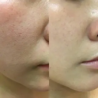 松下 千恵のネイルデザイン