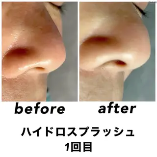 ネイル・エステサロン UILANIのエステ・リラクイメージ