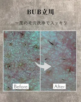 メンズ 【BUB立川】 ゆかのエステ・リラクイメージ