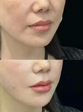 ネイル 愛維美水光専門店 川崎彩鳳のエステ・リラクイメージ