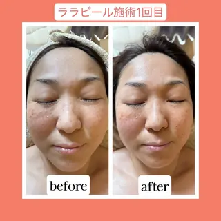 💜Karen PrivateSpaのエステ・リラクイメージ